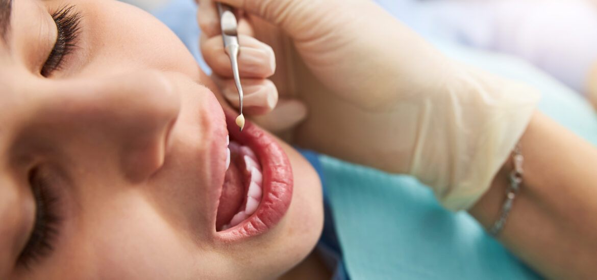 closeup of young woman undergoing a routine dental checkup