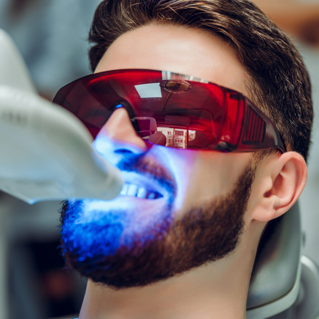 san jose man getting opalescence teeth whitening in a dentist office