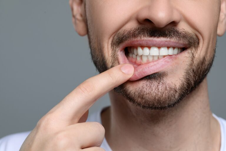 young man pulling down lip exposing healthy gums