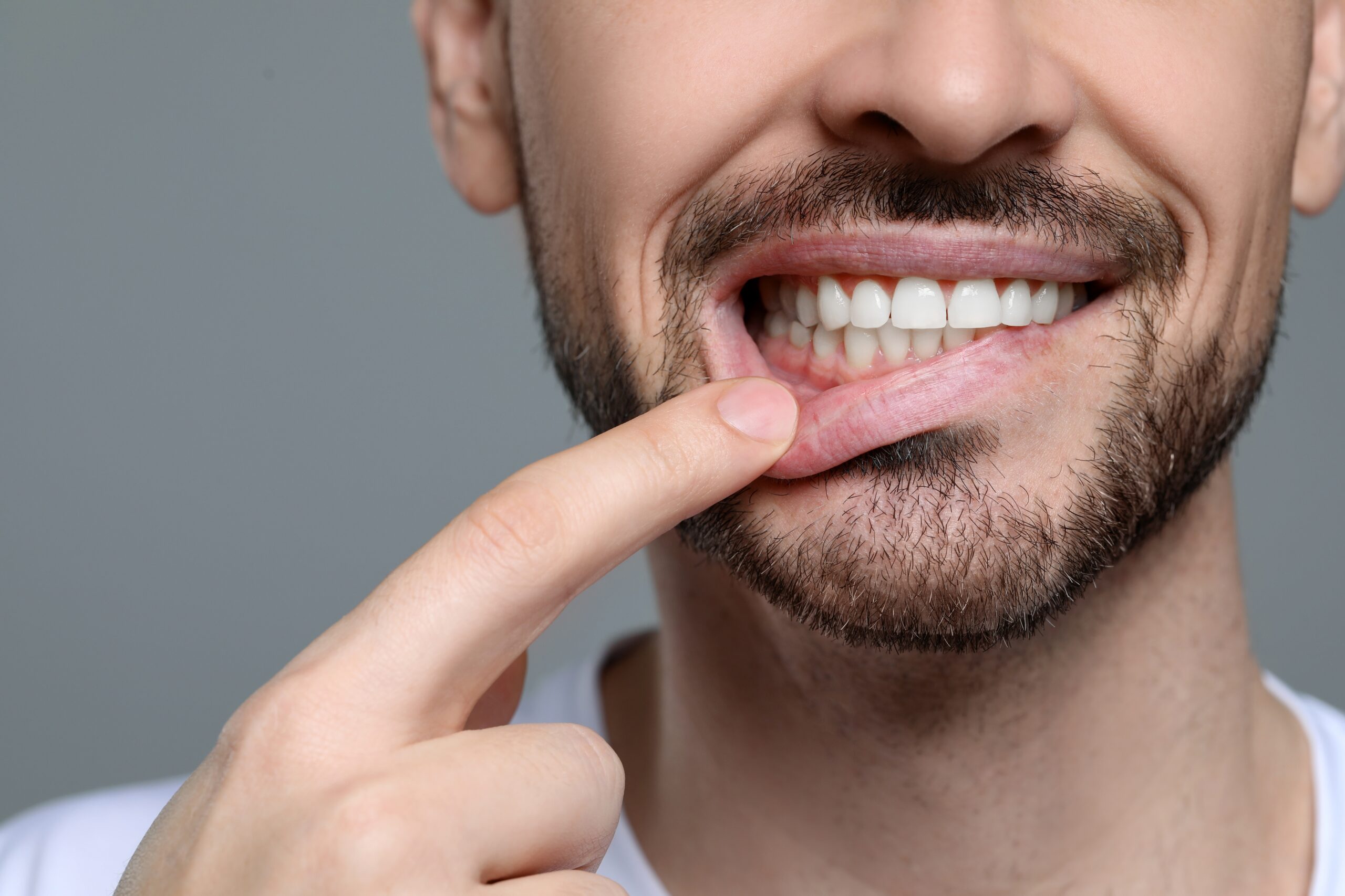 young man pulling down lip exposing healthy gums