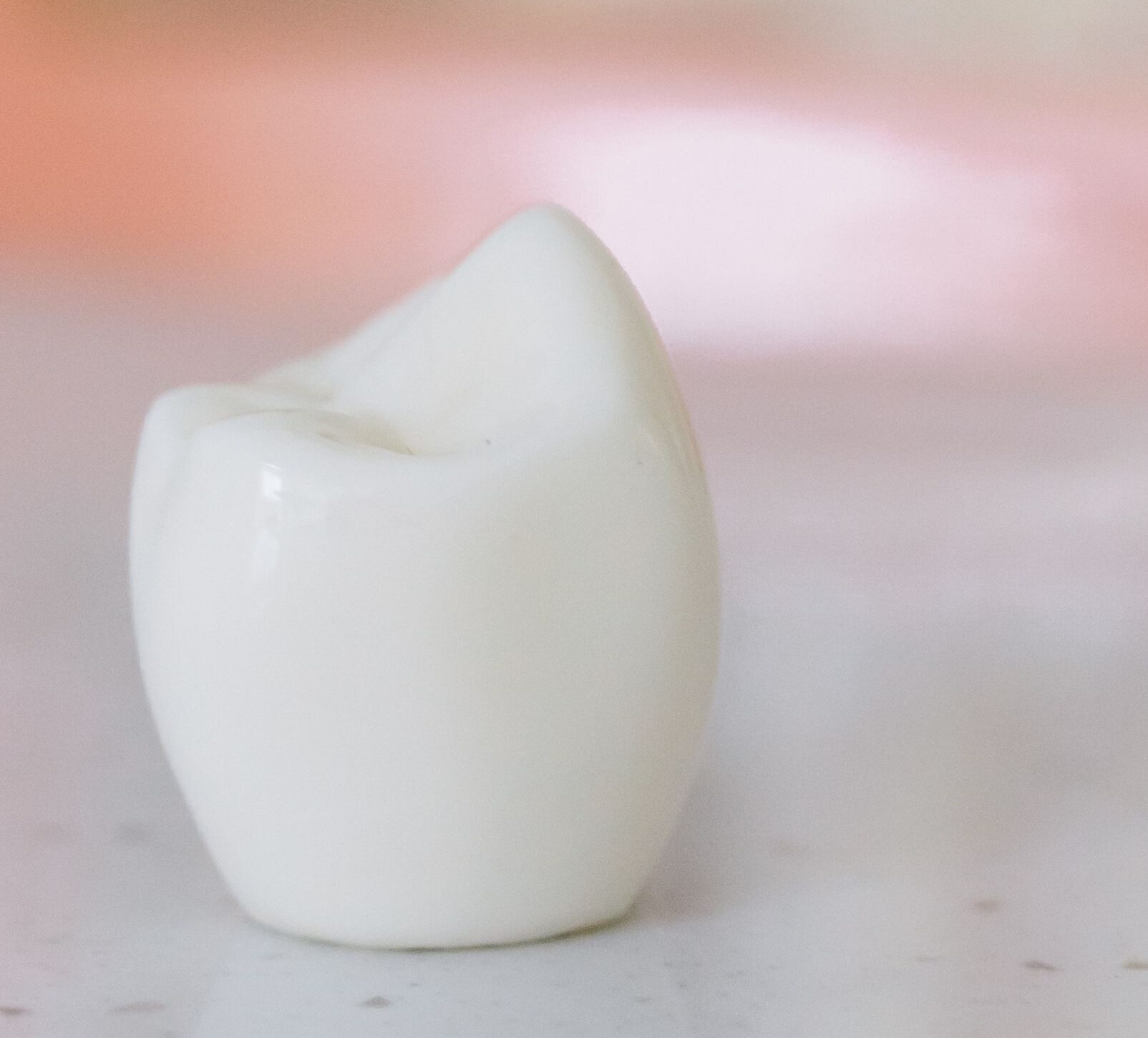 porcelain dental crown - Beveridge Dental in San Jose, CA