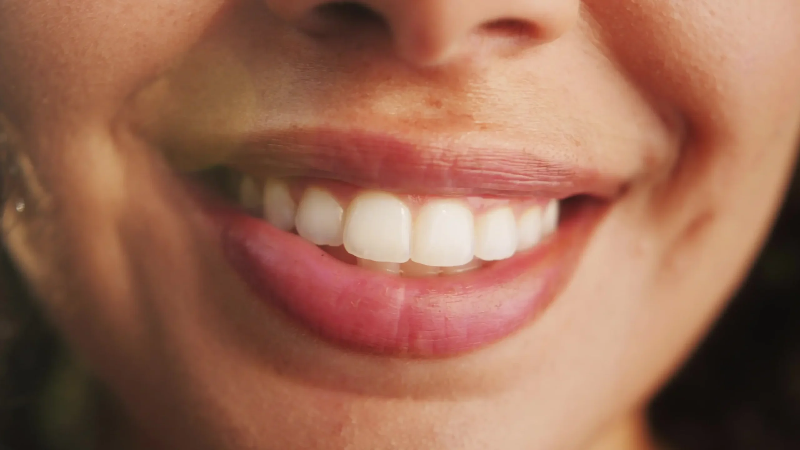 san jose woman with flawless smile after dental bonding