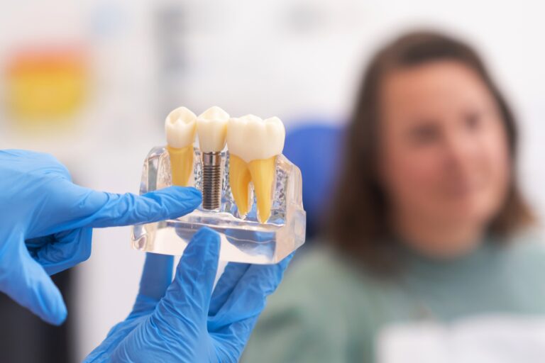 doctor in blue gloves showing a woman a dental implant